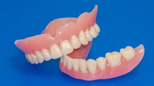 Photo of traditional dentures as a way to replace regular teeth when they are missing. This is an alternative to dental implant supported dentures.